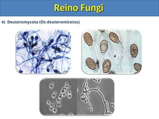 Reino Fungi
Reino Fungi
4) Deuteromycota (Os deuteromicetos)
 