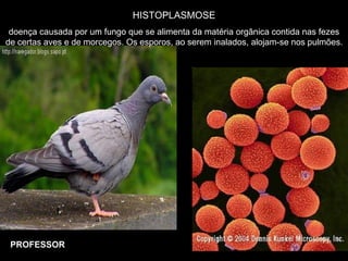 HISTOPLASMOSE
doença causada por um fungo que se alimenta da matéria orgânica contida nas fezes
de certas aves e de morcegos. Os esporos, ao serem inalados, alojam-se nos pulmões.
PROFESSOR
 