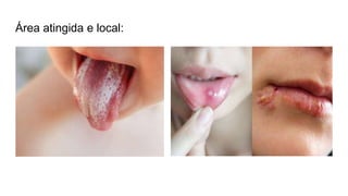 Área atingida e local:
 