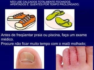 NÃO USE CALÇADOS TOTALMENTE FECHADOS,
APERTADOS E QUENTES POR TEMPO PROLONGADO;
Antes de freqüentar praia ou piscina, faça um exame
médico.
Procure não ficar muito tempo com o maiô molhado;
 