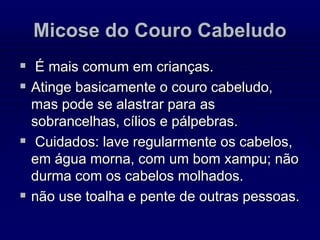 Micose do Couro Cabeludo
 É mais comum em crianças.
 Atinge basicamente o couro cabeludo,
mas pode se alastrar para as
sobrancelhas, cílios e pálpebras.
 Cuidados: lave regularmente os cabelos,
em água morna, com um bom xampu; não
durma com os cabelos molhados.
 não use toalha e pente de outras pessoas.
 