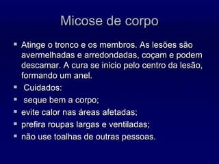 Micose de corpo
 Atinge o tronco e os membros. As lesões são
avermelhadas e arredondadas, coçam e podem
descamar. A cura se inicio pelo centro da lesão,
formando um anel.
 Cuidados:
 seque bem a corpo;
 evite calor nas áreas afetadas;
 prefira roupas largas e ventiladas;
 não use toalhas de outras pessoas.
 