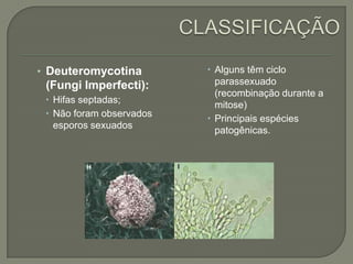 • Deuteromycotina
(Fungi Imperfecti):
 Hifas septadas;
 Não foram observados
esporos sexuados
 Alguns têm ciclo
parassexuado
(recombinação durante a
mitose)
 Principais espécies
patogênicas.
 