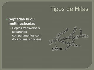  Septadas bi ou
multinucleadas
• Septos transversais
separando
compartimentos com
dois ou mais núcleos.
 
