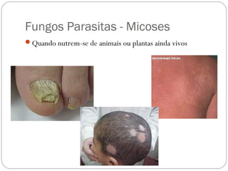 Fungos Parasitas - Micoses
Quando nutrem-se de animais ou plantas ainda vivos
 