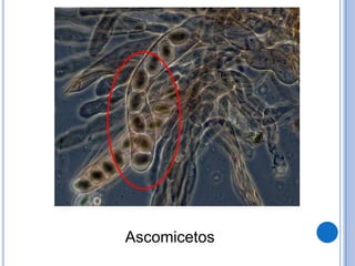 Ascomicetos
 
