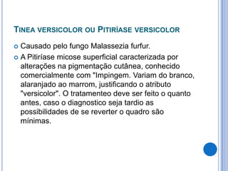TINEA VERSICOLOR OU PITIRÍASE VERSICOLOR
 Causado pelo fungo Malassezia furfur.
 A Pitiríase micose superficial caracterizada por
alterações na pigmentação cutânea, conhecido
comercialmente com "Impingem. Variam do branco,
alaranjado ao marrom, justificando o atributo
"versicolor". O tratamenteo deve ser feito o quanto
antes, caso o diagnostico seja tardio as
possibilidades de se reverter o quadro são
mínimas.
 