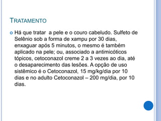 TRATAMENTO
 Há que tratar a pele e o couro cabeludo. Sulfeto de
Selênio sob a forma de xampu por 30 dias,
enxaguar após 5 minutos, o mesmo é também
aplicado na pele; ou, associado a antimicóticos
tópicos, cetoconazol creme 2 a 3 vezes ao dia, até
o desaparecimento das lesões. A opção de uso
sistêmico é o Cetoconazol, 15 mg/kg/dia por 10
dias e no adulto Cetoconazol – 200 mg/dia, por 10
dias.
 