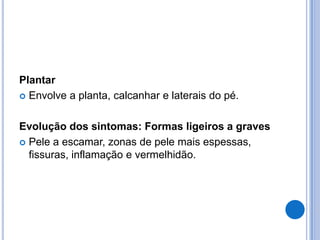 Plantar
 Envolve a planta, calcanhar e laterais do pé.
Evolução dos sintomas: Formas ligeiros a graves
 Pele a escamar, zonas de pele mais espessas,
fissuras, inflamação e vermelhidão.
 
