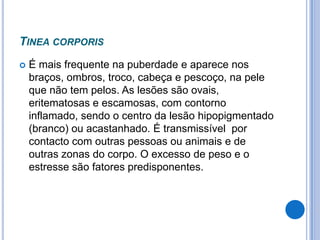 TINEA CORPORIS
 É mais frequente na puberdade e aparece nos
braços, ombros, troco, cabeça e pescoço, na pele
que não tem pelos. As lesões são ovais,
eritematosas e escamosas, com contorno
inflamado, sendo o centro da lesão hipopigmentado
(branco) ou acastanhado. É transmissível por
contacto com outras pessoas ou animais e de
outras zonas do corpo. O excesso de peso e o
estresse são fatores predisponentes.
 