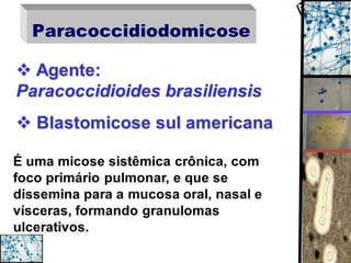 paracoccidioides
brasiliensis
 