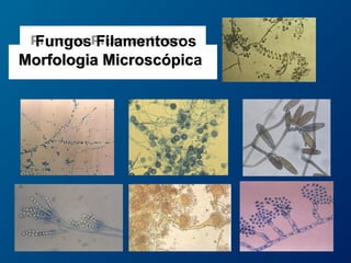 Fungos Filamentosos
Morfologia Microscópica
 