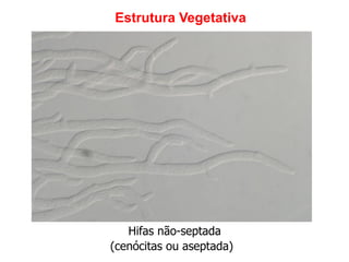 Hifas não-septada
(cenócitas ou aseptada)
Estrutura Vegetativa
 