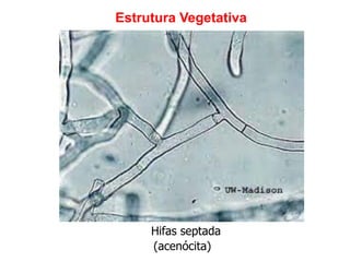Hifas septada
(acenócita)
Estrutura Vegetativa
 