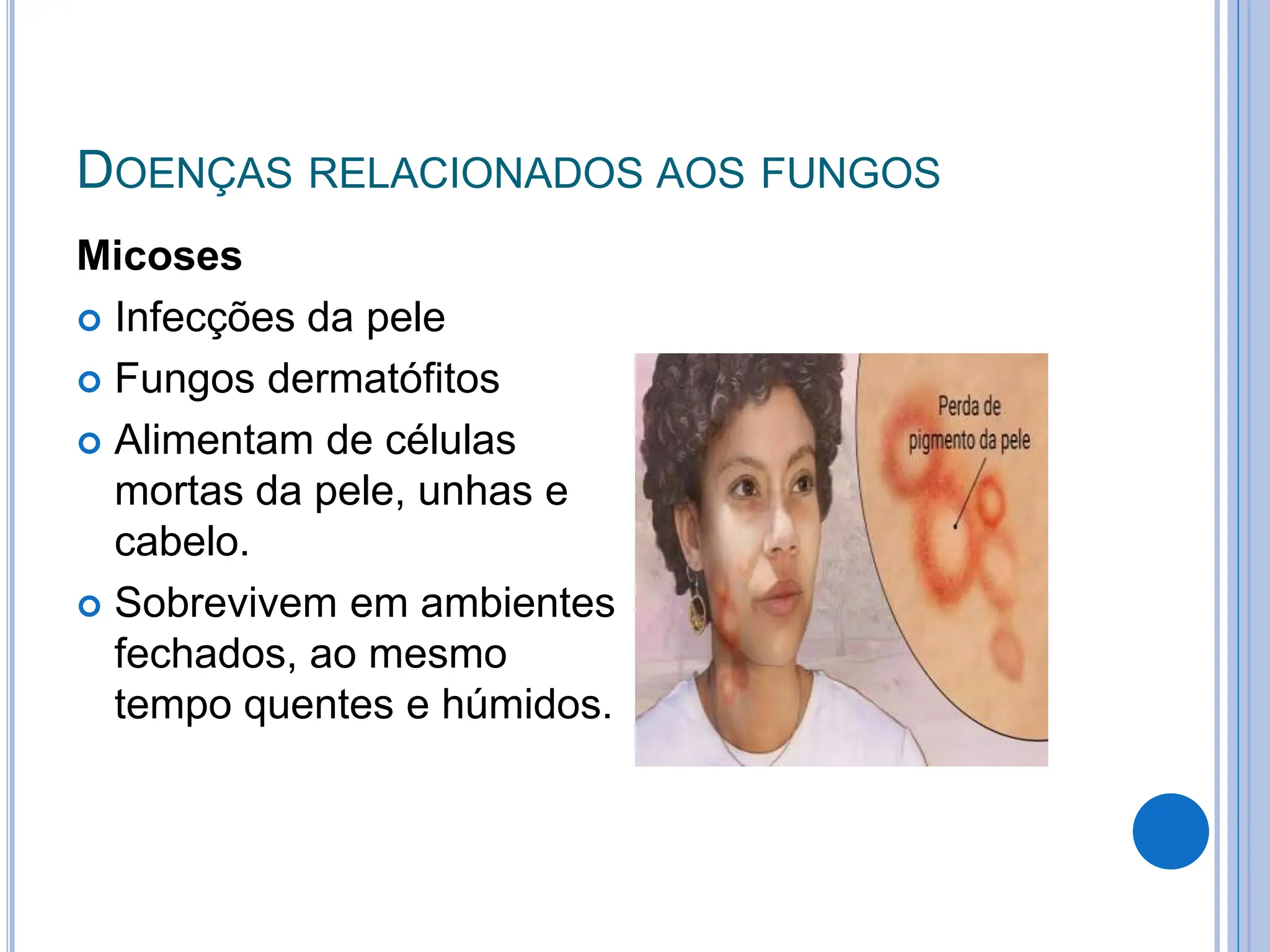 Doenças Causada Por Fungos - BINKEDU