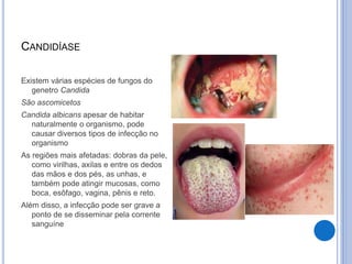 Fungos parte - parasitismo e doenças causadas por esse reino biológico ...
