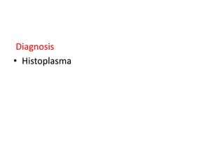 Diagnosis
• Histoplasma
 