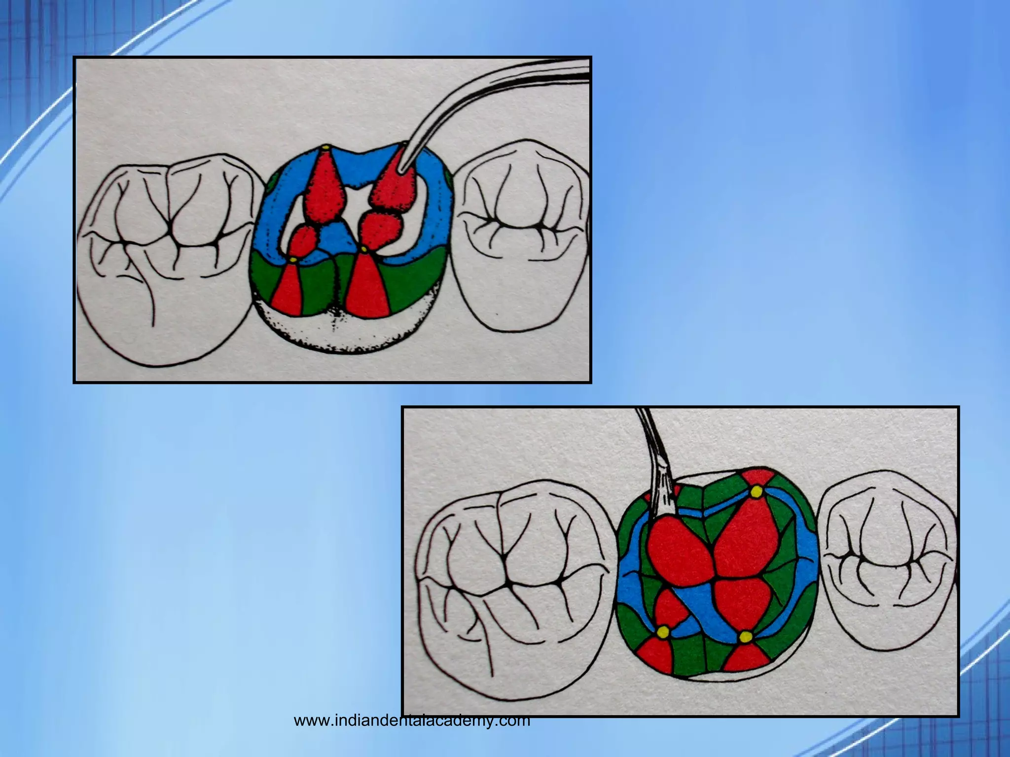 Funl occlusal wax/dental courses PPT