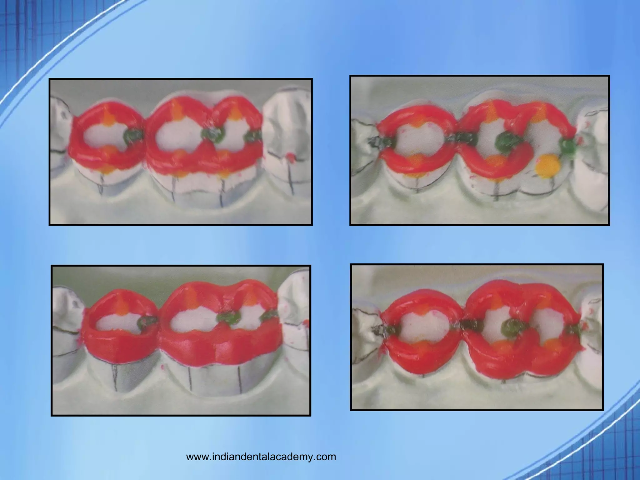 Funl occlusal wax/dental courses PPT