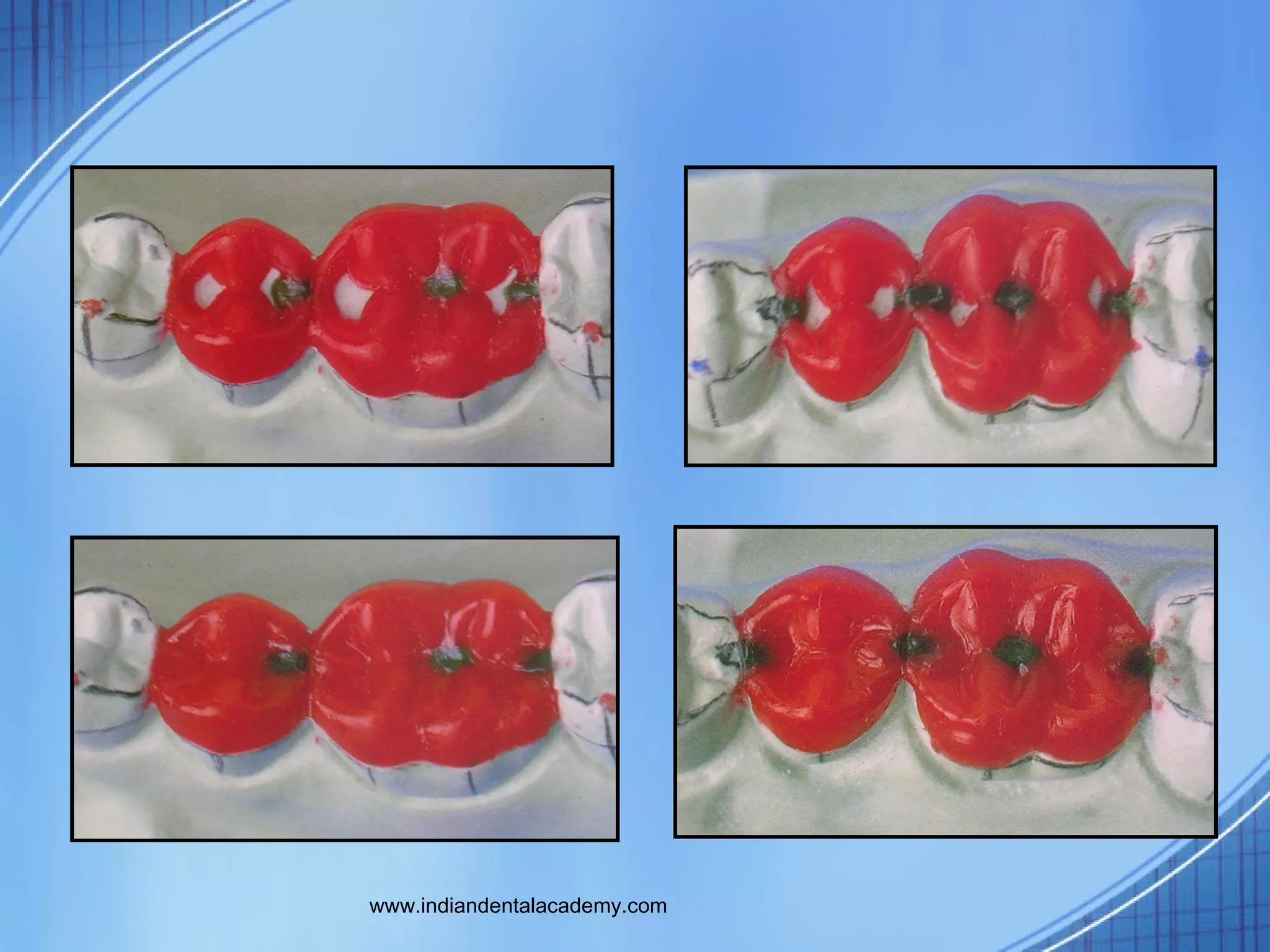 Funl occlusal wax/dental courses PPT