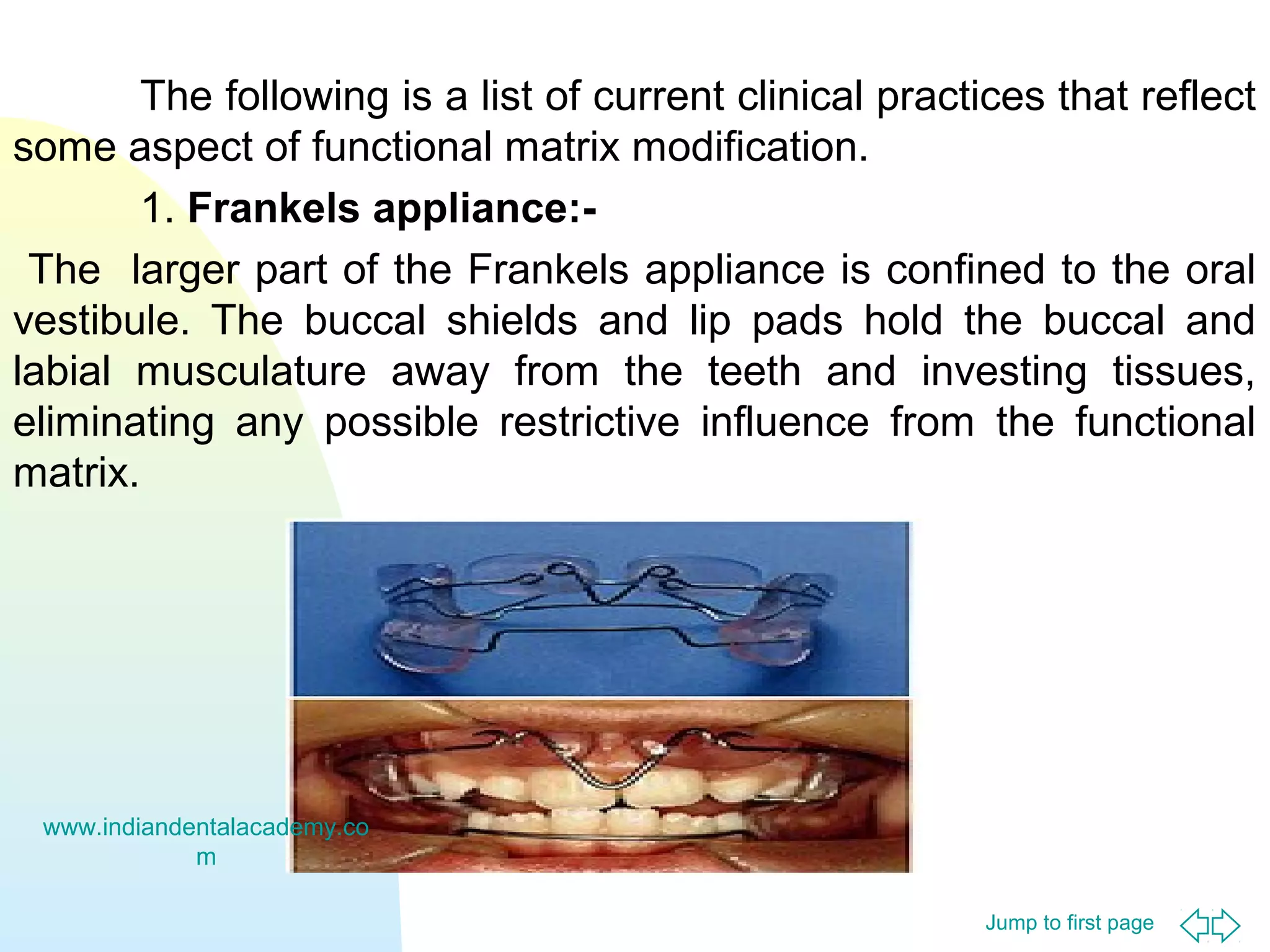 The following is a list of current clinical practices that reflect
some aspect of functional matrix modification.
1. Frankels appliance:The larger part of the Frankels appliance is confined to the oral
vestibule. The buccal shields and lip pads hold the buccal and
labial musculature away from the teeth and investing tissues,
eliminating any possible restrictive influence from the functional
matrix.

www.indiandentalacademy.co
m
Jump to first page

 
