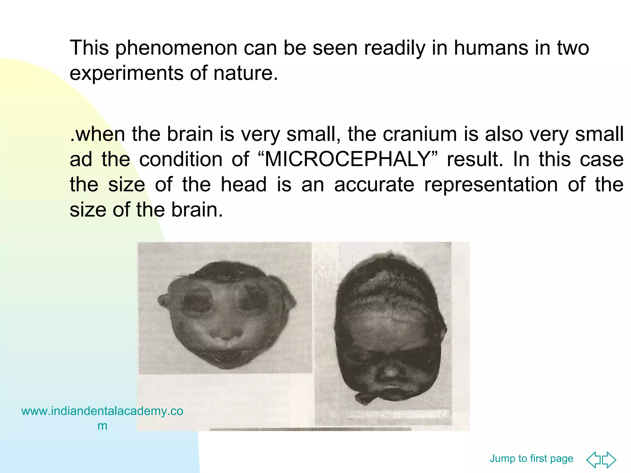 This phenomenon can be seen readily in humans in two
experiments of nature.
.when the brain is very small, the cranium is also very small
ad the condition of “MICROCEPHALY” result. In this case
the size of the head is an accurate representation of the
size of the brain.

www.indiandentalacademy.co
m
Jump to first page

 