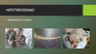 HIPOTIREOIDISMO
• DISGNÓSTICO CLÍNICO
 