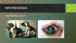 HIPOTIREOIDISMO
• DISGNÓSTICO CLÍNICO
 