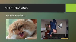 HIPERTIREOIDISMO
• DIAGNÓSTICO CLÍNICO
 