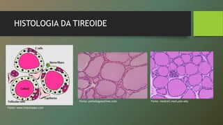 HISTOLOGIA DA TIREOIDE
Fonte: medcell.med.yale.eduFonte: pathologyoutlines.com
Fonte: www.intechopen.com
 