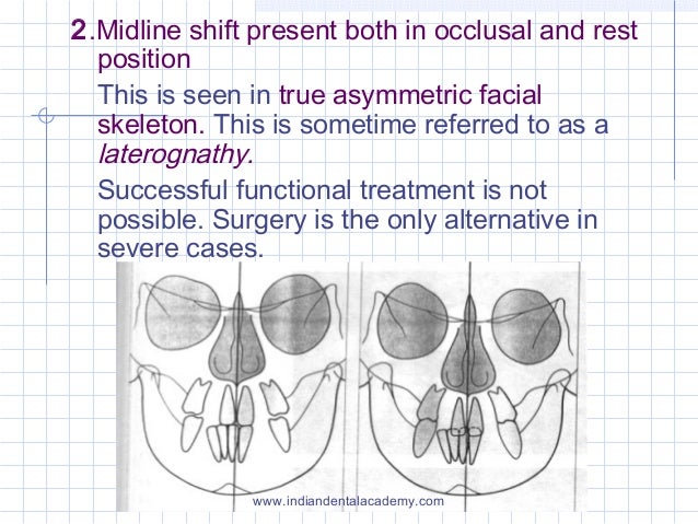 cross funtional dysfunction Don’t confuse the definition of team with the definition of a cross-functional team as this will a difference between a work group and a functional. cross funtional dysfunction Don’t confuse the definition of team with the definition of a cross-functional team as this will a difference between a work group and a functional.