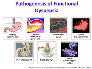 Motility
abnormalities
Excessive
secretion of
gastric acid
Helicobacter
pylori
Visceral
hypersensitivity
Post-infectious FD Diet & Life style
Genetics
&Psychological
factors
Adapted from Miwa H., et al. Journal of Gastroenterology and Hepatology 26 (2011) Suppl. 3; 53–60
 