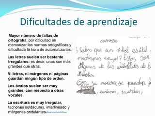 Dificultades de aprendizaje
Mayor número de faltas de
ortografía: por dificultad en
memorizar las normas ortográficas y
dificultada la hora de automatizarlas.
Las letras suelen ser bastante
irregulares: es decir, unas son más
grandes que otras.
Ni letras, ni márgenes ni páginas
guardan ningún tipo de orden.
Los óvalos suelen ser muy
grandes, con respecto a otras
vocales.
La escritura es muy irregular,
tachones soldaduras, interlineado y
márgenes ondulantes.#dislexiatdahbilbao
 