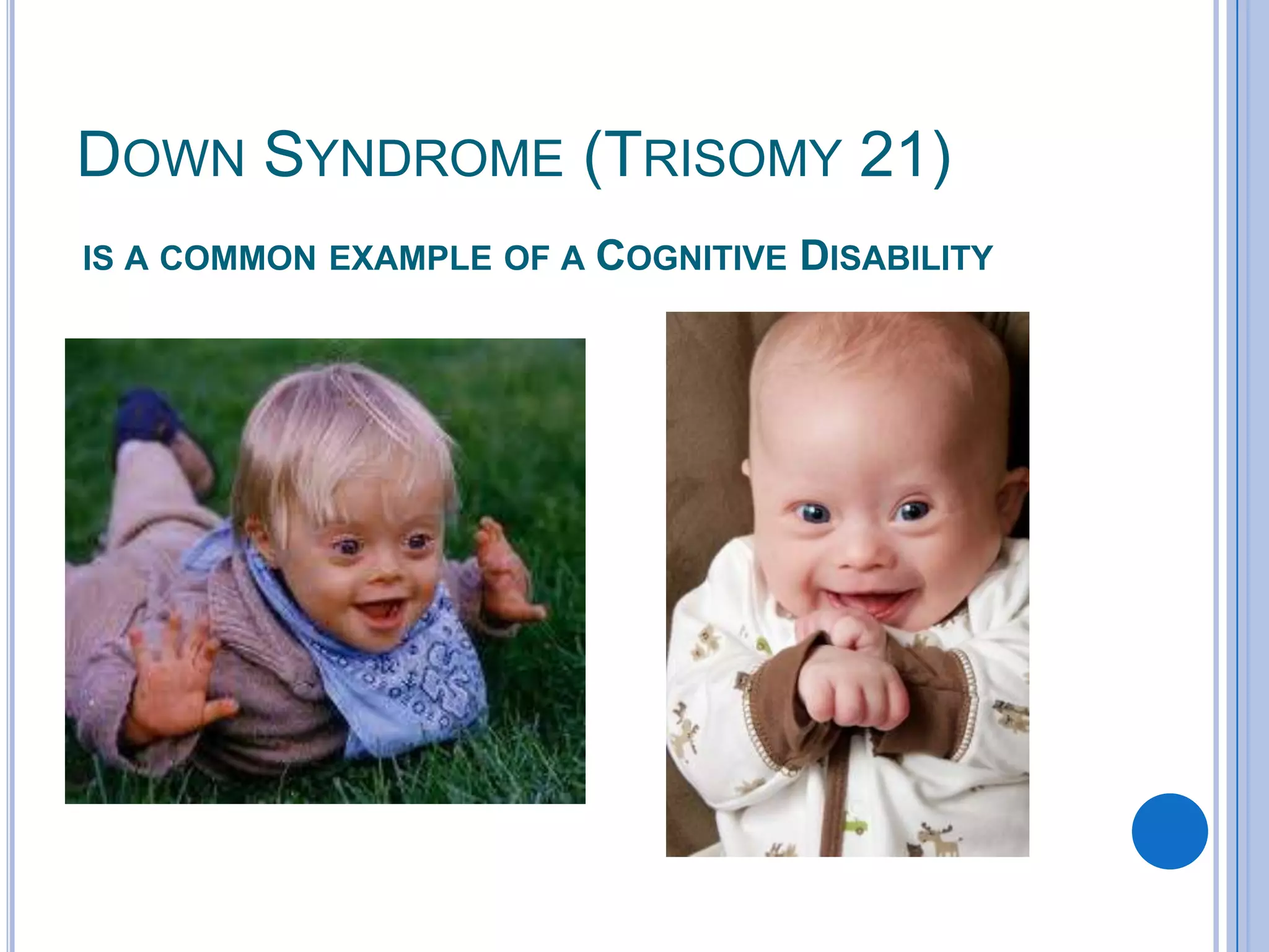 DOWN SYNDROME (TRISOMY 21)
IS A COMMON EXAMPLE OF A   COGNITIVE DISABILITY
 