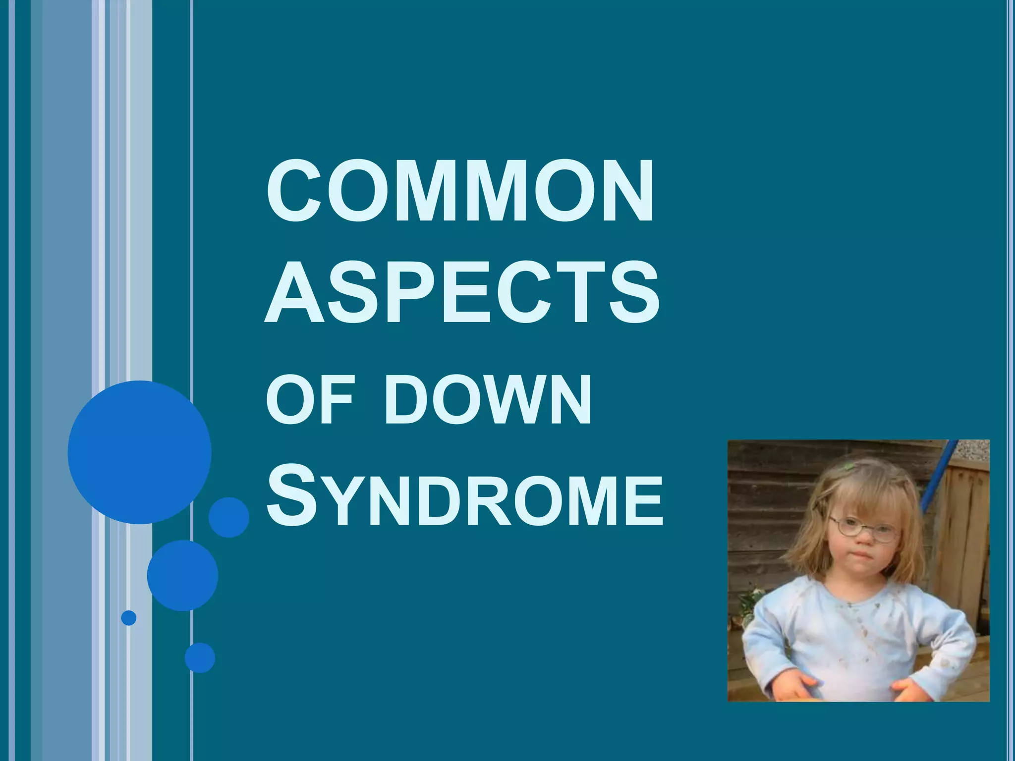 COMMON
ASPECTS
OF DOWN
SYNDROME
 