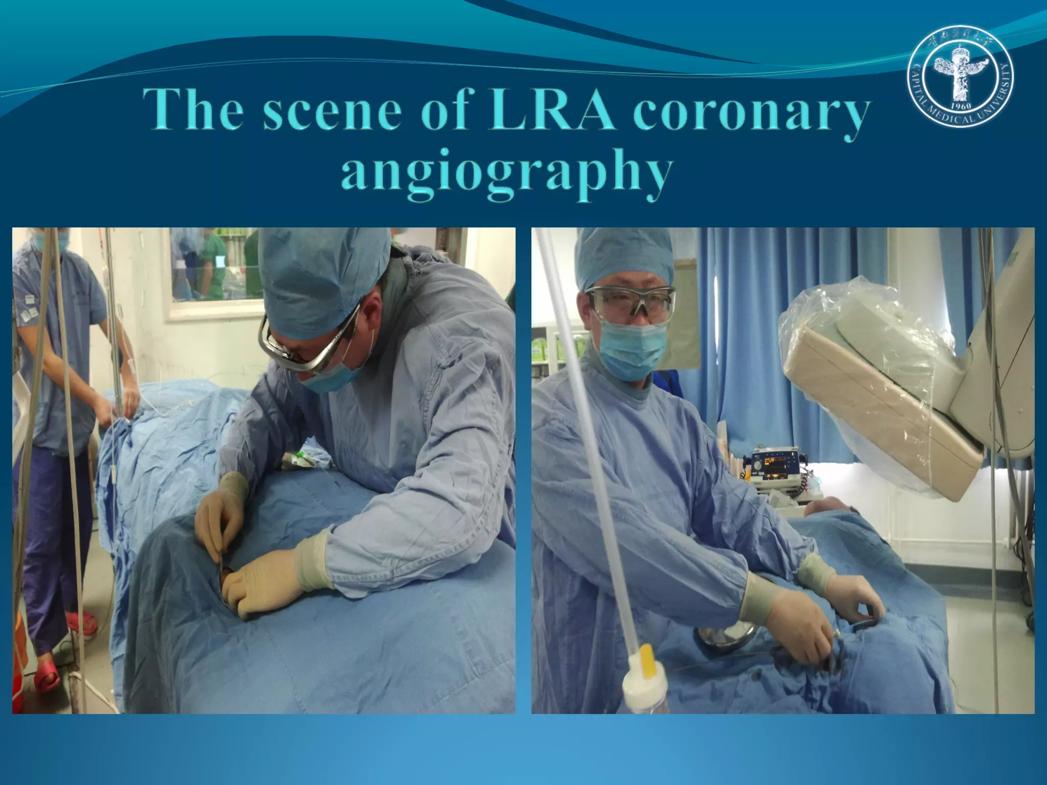Fu Q - AIMRADIAL 2014 - Left vs right radial approach