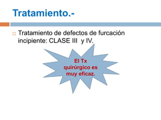  Tratamiento de defectos de furcación
incipiente: CLASE III y IV.
Tratamiento.-
El Tx
quirúrgico es
muy eficaz.
 