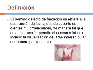 Definición
 El término defecto de furcación se refiere a la
destrucción de los tejidos de soporte de
dientes multirradiculares, de manera tal que
esta destrucción permite el acceso clínico o
incluso la visualización del área interradicular
de manera parcial o total.
 