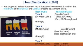 molar Root furcation involvement & treatement.pptx