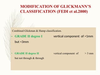 Hamp Classification Comprehensive Overview of Furcation Involvement and Its Management in ...