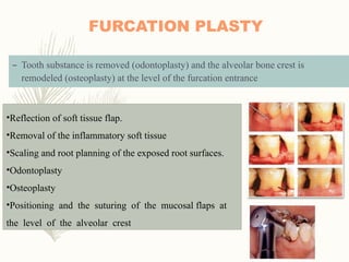 Comprehensive Overview of Furcation Involvement and Its Management in ...