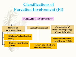 Hamp Classification Comprehensive Overview of Furcation Involvement and Its Management in ...