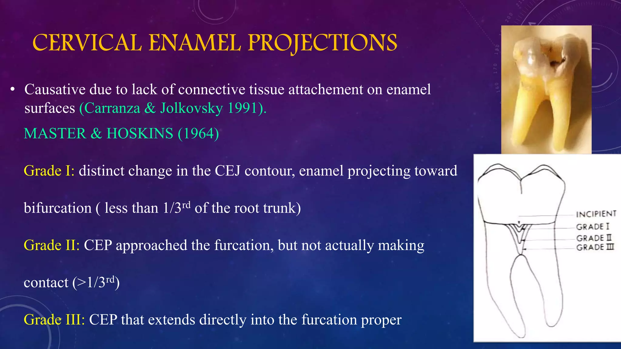 CERVICAL ENAMEL PROJECTIONS
• Causative due to lack of connective tissue attachement on enamel
surfaces (Carranza & Jolkovsky 1991).
MASTER & HOSKINS (1964)
Grade I: distinct change in the CEJ contour, enamel projecting toward
bifurcation ( less than 1/3rd of the root trunk)
Grade II: CEP approached the furcation, but not actually making
contact (>1/3rd)
Grade III: CEP that extends directly into the furcation proper
 