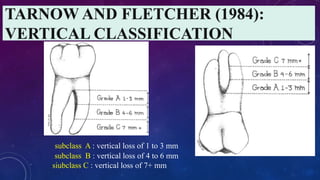 subclass A : vertical loss of 1 to 3 mm
subclass B : vertical loss of 4 to 6 mm
siubclass C : vertical loss of 7+ mm
 