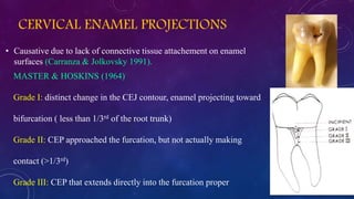 CERVICAL ENAMEL PROJECTIONS
• Causative due to lack of connective tissue attachement on enamel
surfaces (Carranza & Jolkovsky 1991).
MASTER & HOSKINS (1964)
Grade I: distinct change in the CEJ contour, enamel projecting toward
bifurcation ( less than 1/3rd of the root trunk)
Grade II: CEP approached the furcation, but not actually making
contact (>1/3rd)
Grade III: CEP that extends directly into the furcation proper
 
