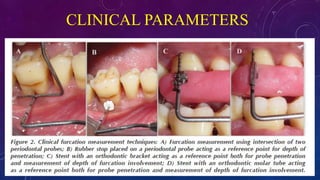 CLINICAL PARAMETERS
 