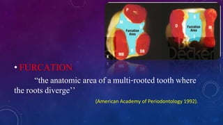 • FURCATION
“the anatomic area of a multi-rooted tooth where
the roots diverge’’
(American Academy of Periodontology 1992).
 