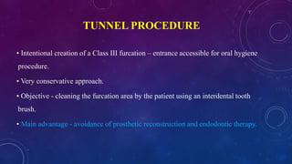 TUNNEL PROCEDURE
• Intentional creation of a Class III furcation – entrance accessible for oral hygiene
procedure.
• Very conservative approach.
• Objective - cleaning the furcation area by the patient using an interdental tooth
brush.
• Main advantage - avoidance of prosthetic reconstruction and endodontic therapy.
 