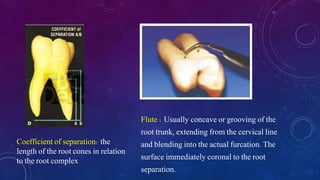 Coefficient of separation: the
length of the root cones in relation
to the root complex
Flute : Usually concave or grooving of the
root trunk, extending from the cervical line
and blending into the actual furcation. The
surface immediately coronal to the root
separation.
 