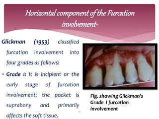 Hamp Classification FURCATION and its classification 1 .pptx